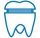 Crown Preparation